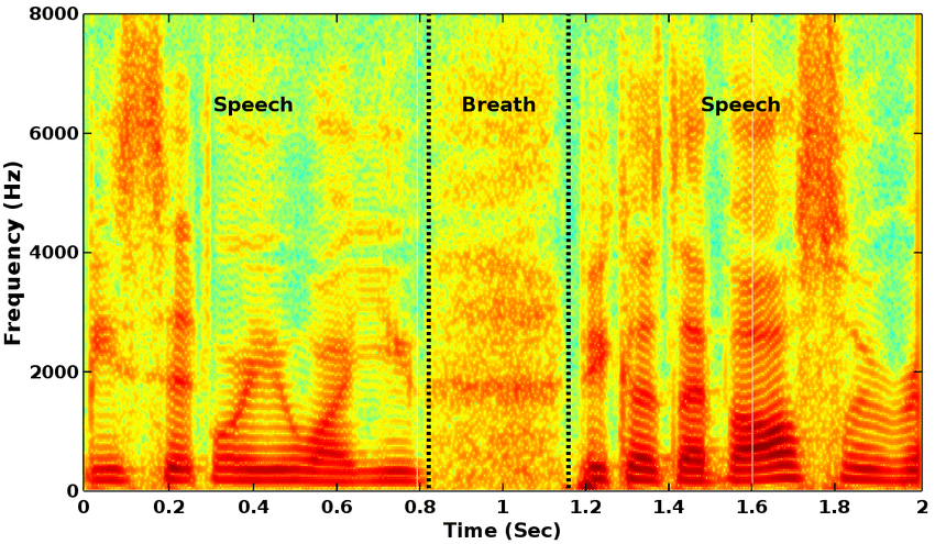 voice spectrogram